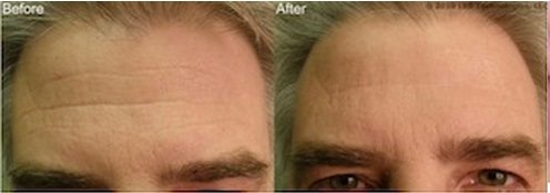 reVive Anti-Aging Before and After 2